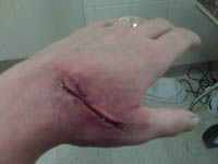 Hand Wound - Jodi Byrne Special FX Makeup Artist